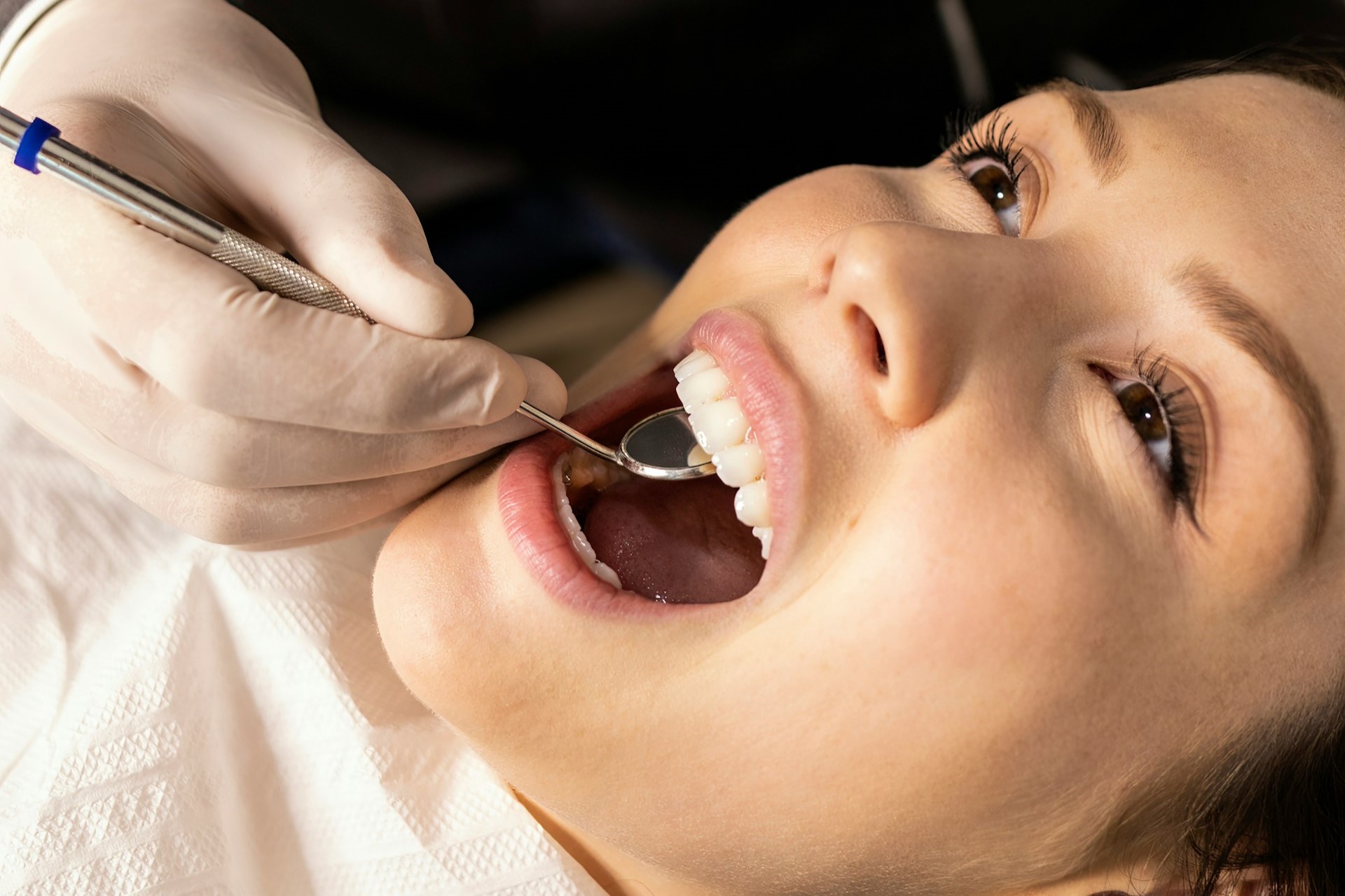 Dental Bonding for Gaps
