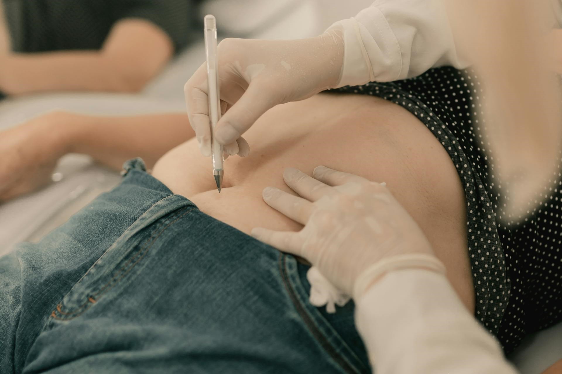 How Much Does Liposuction Cost in the UK