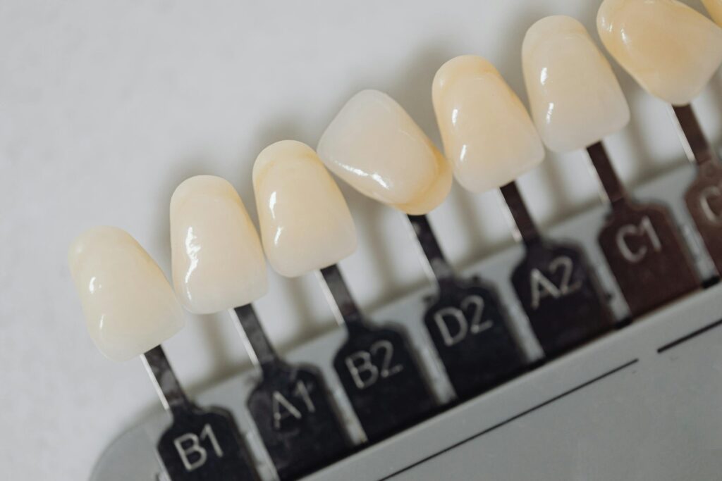 Composite Resin vs Porcelain for Cosmetic Repairs
