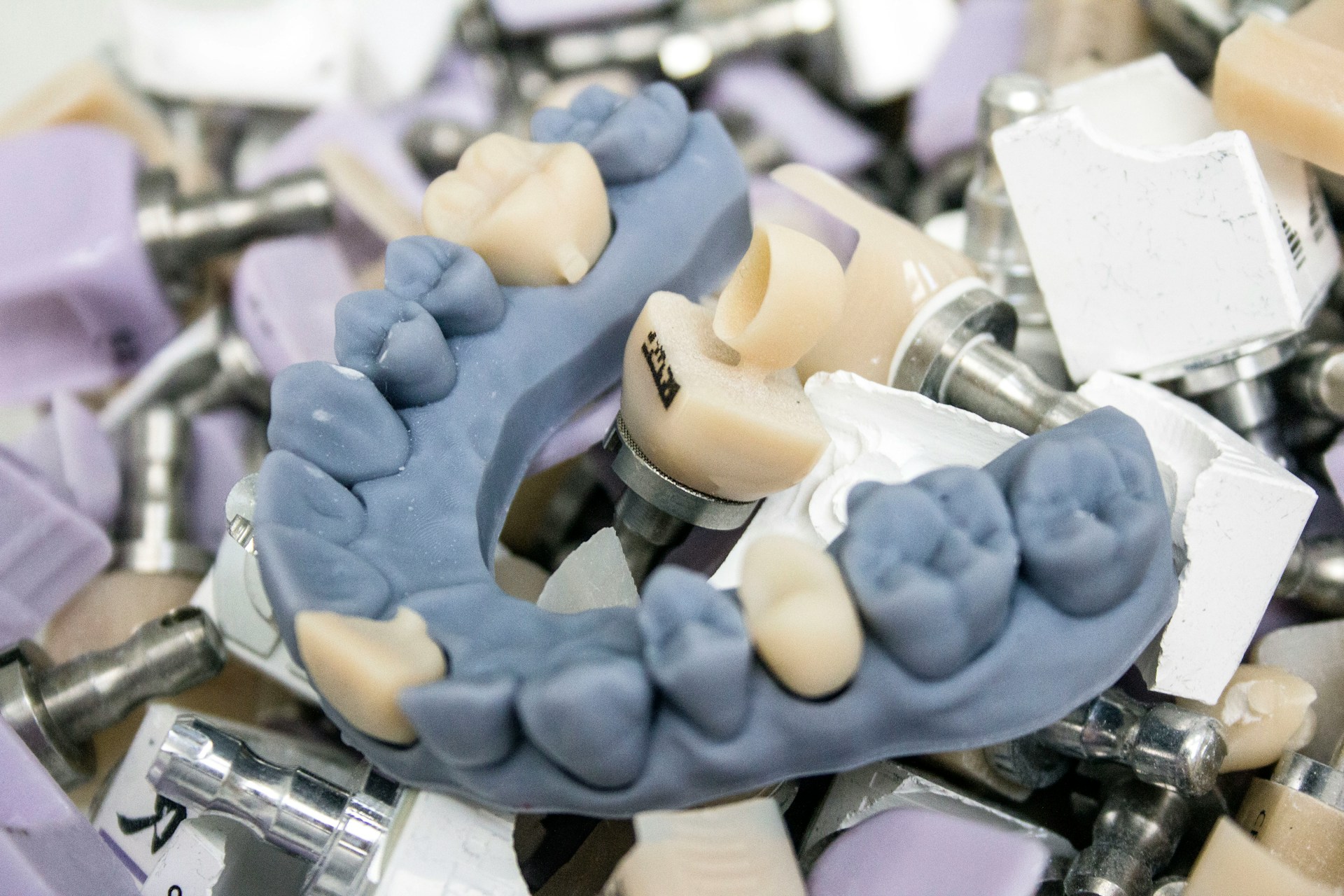 Dental Bonding vs Crowns